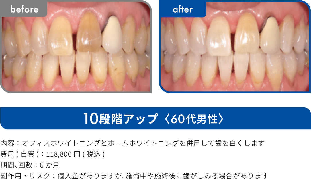 10段階アップ 60代男性