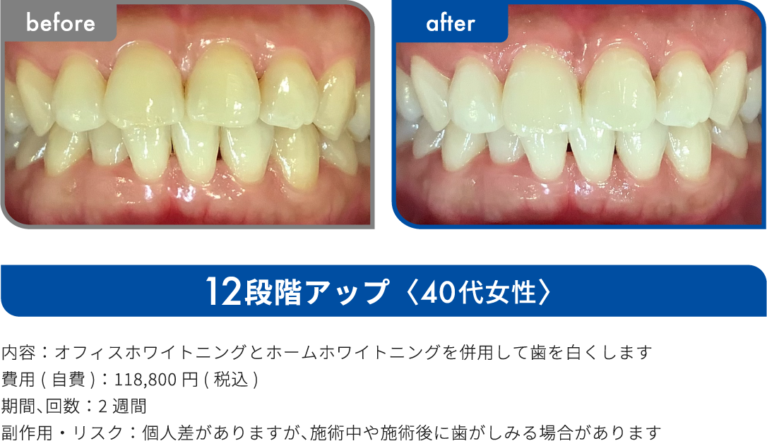 12段階アップ 40代女性