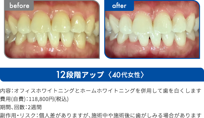 12段階アップ 40代女性