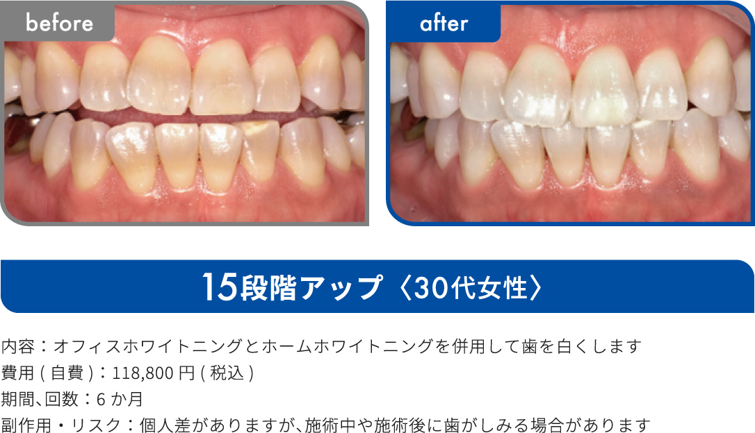 15段階アップ 30代女性