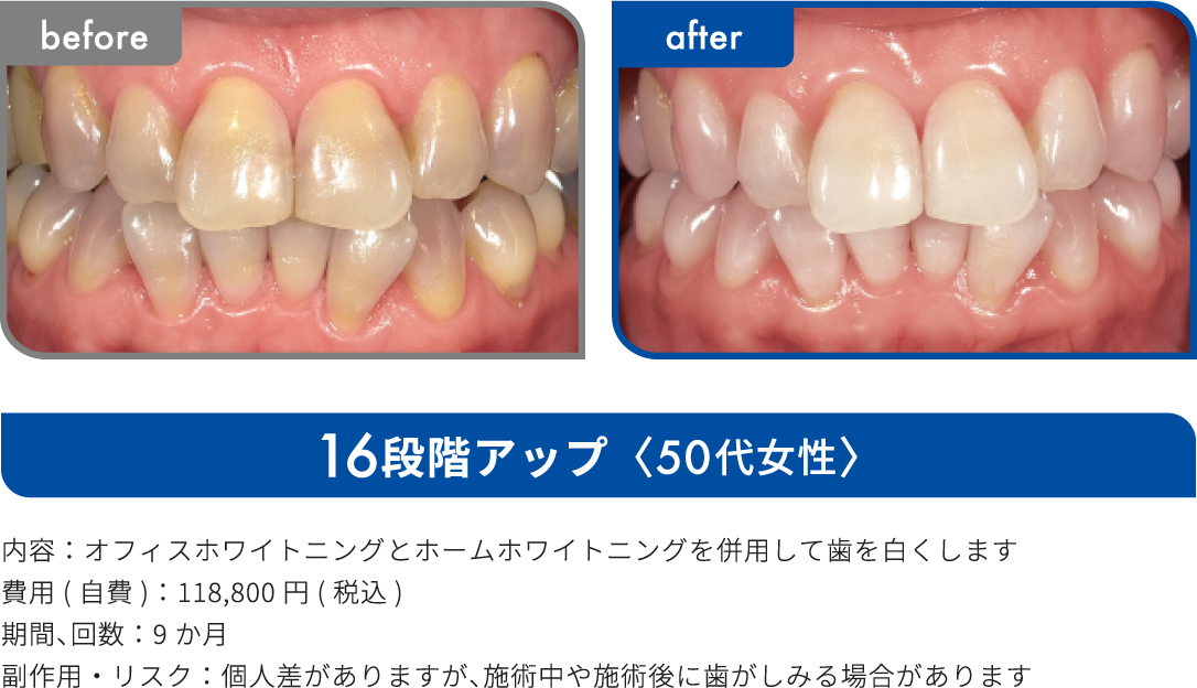 16段階アップ 50代女性