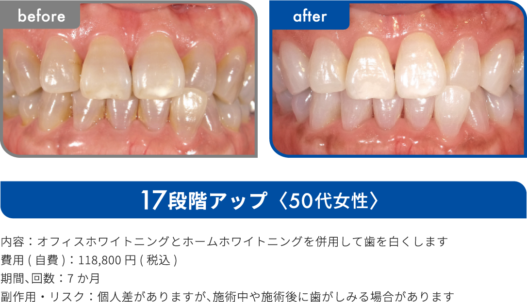 17段階アップ 50代女性