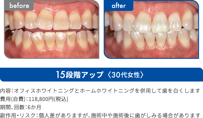 15段階アップ 30代女性