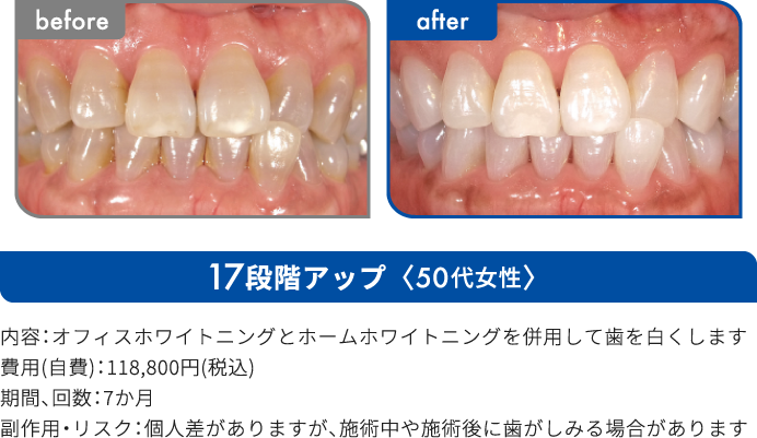 17段階アップ 50代女性